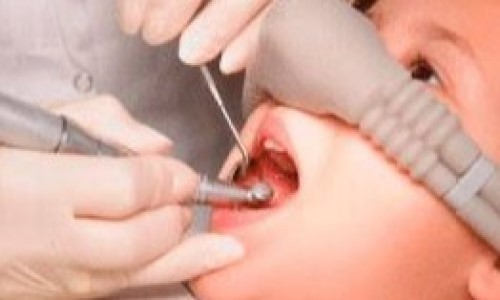 sedacao